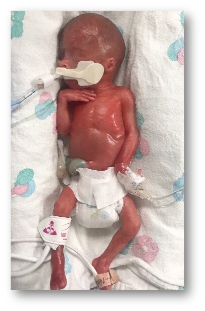 Our Tiny Angel