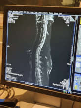 Smartman's MRI Image