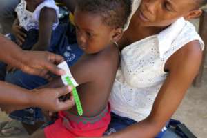 Measuring arm size as indicator of malnutrition