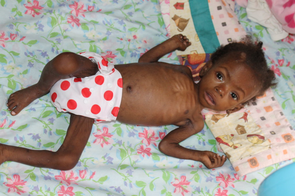 Hurricane Matthew: Saving Haitian Babies in Need