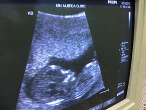 First Sonogram of healthy baby Mohamed