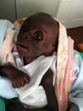 Baby Peter on arrival to our hospital