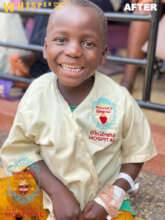 Hashim smiling after treatment