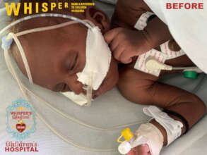Baby Ziwa during treatment