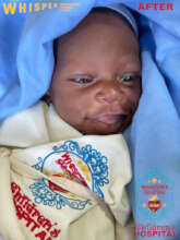 Baby Ziwa after healing