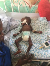 3 months old malnourished Hope on oxygen on 14.01
