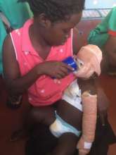 One of our patients with severe face burns