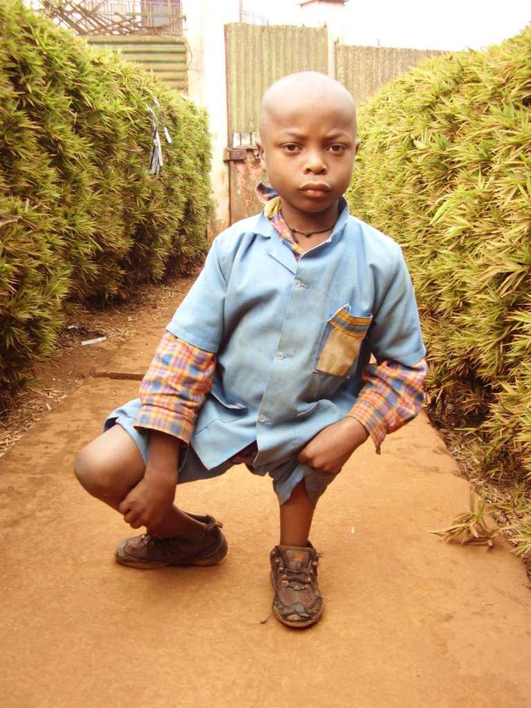 New Centre to Treat Disabled Children in Cameroon