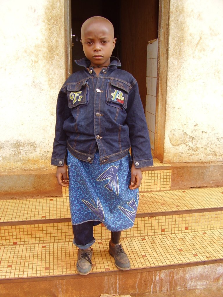 New Centre to Treat Disabled Children in Cameroon