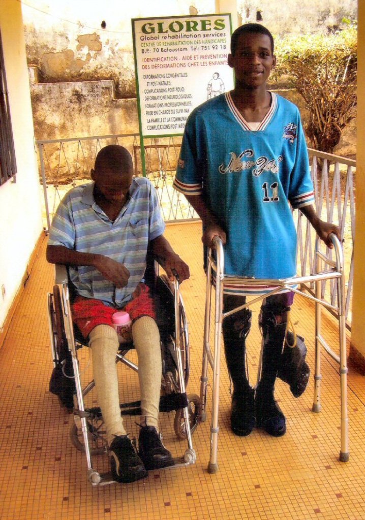 New Centre to Treat Disabled Children in Cameroon