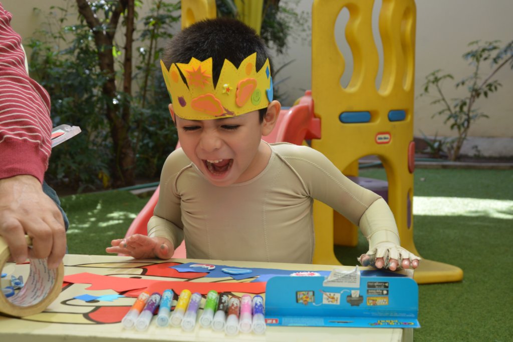 One Year Physiotherapy for 30 Burned Peruvian Kids