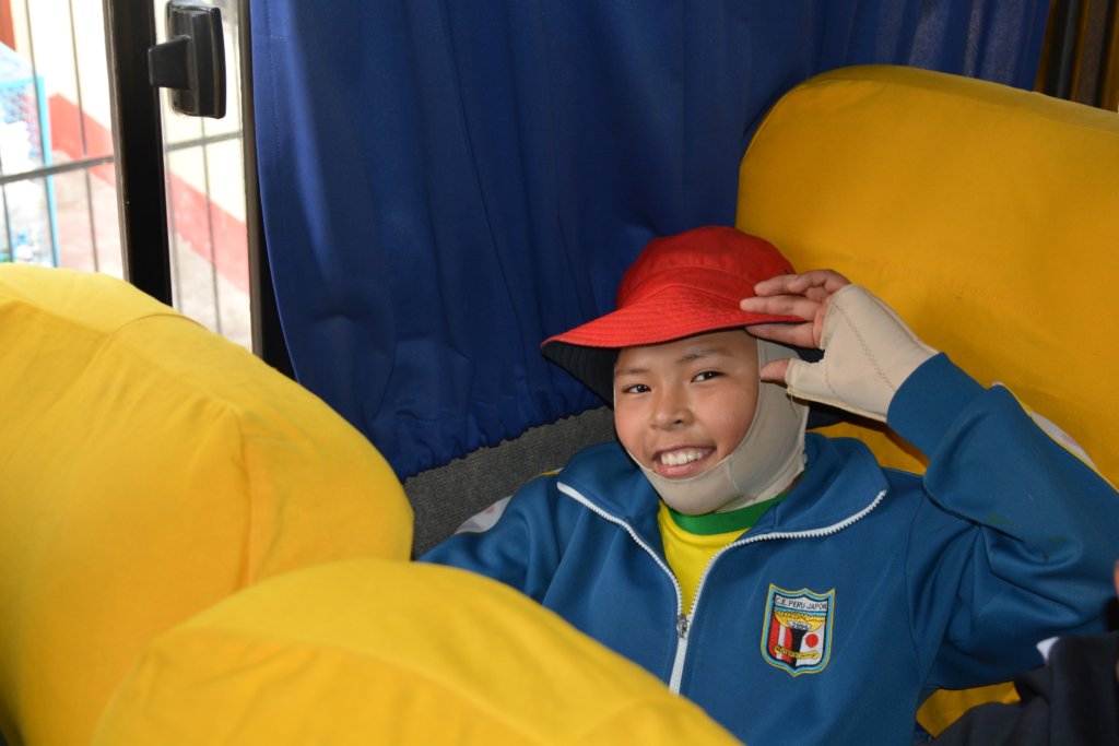 One Year Physiotherapy for 30 Burned Peruvian Kids