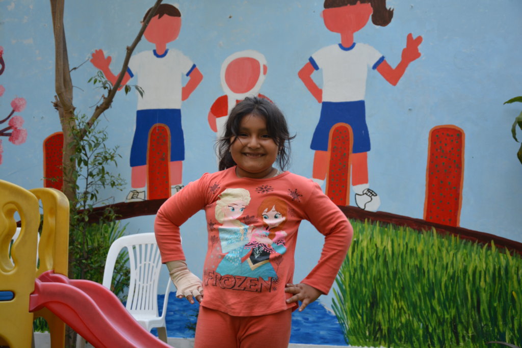 One Year Physiotherapy for 30 Burned Peruvian Kids