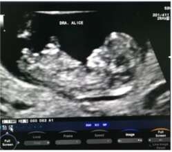 Clinic -  Gynaecologist Area - Echos - Foetuses