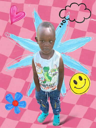 Emmanuel before surgery
