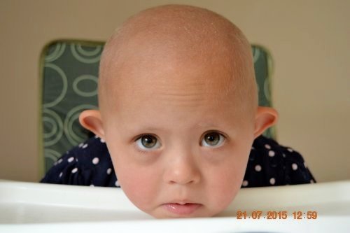 Amanda during her treatment