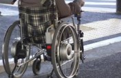 Hip Replacement for 12 Nigerians with Sickle Cell