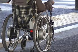 Hip Replacement for 12 Nigerians with Sickle Cell