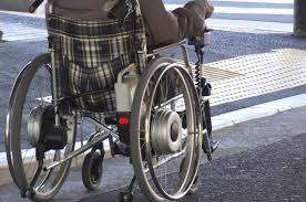 Hip Replacement for 12 Nigerians with Sickle Cell