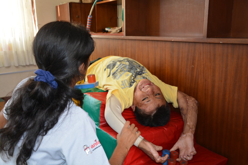 Rehabilitation for 7 Burned Children in Peru