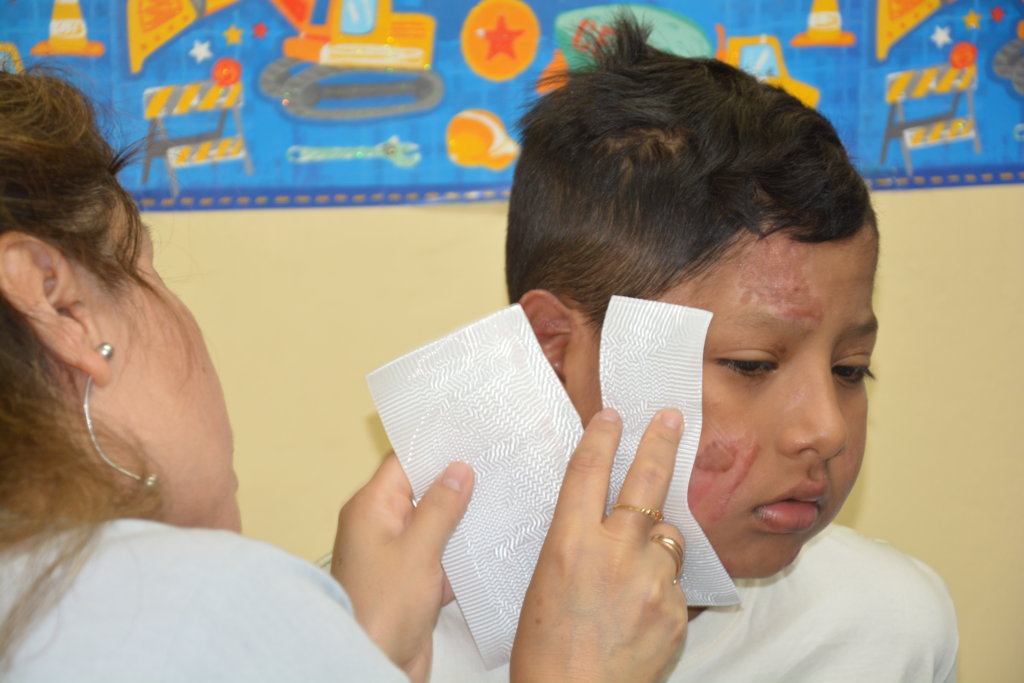 Rehabilitation for 7 Burned Children in Peru