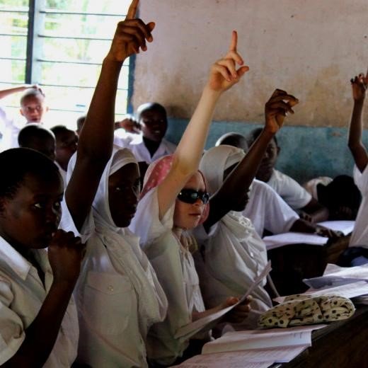 Improving the lives of People with Albinism