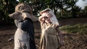albino children wearing huts with widder brims