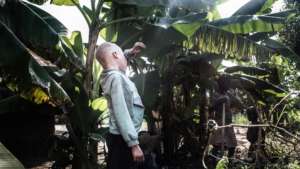 An albino child tries his luck to protect himself