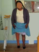 Angela with new leg