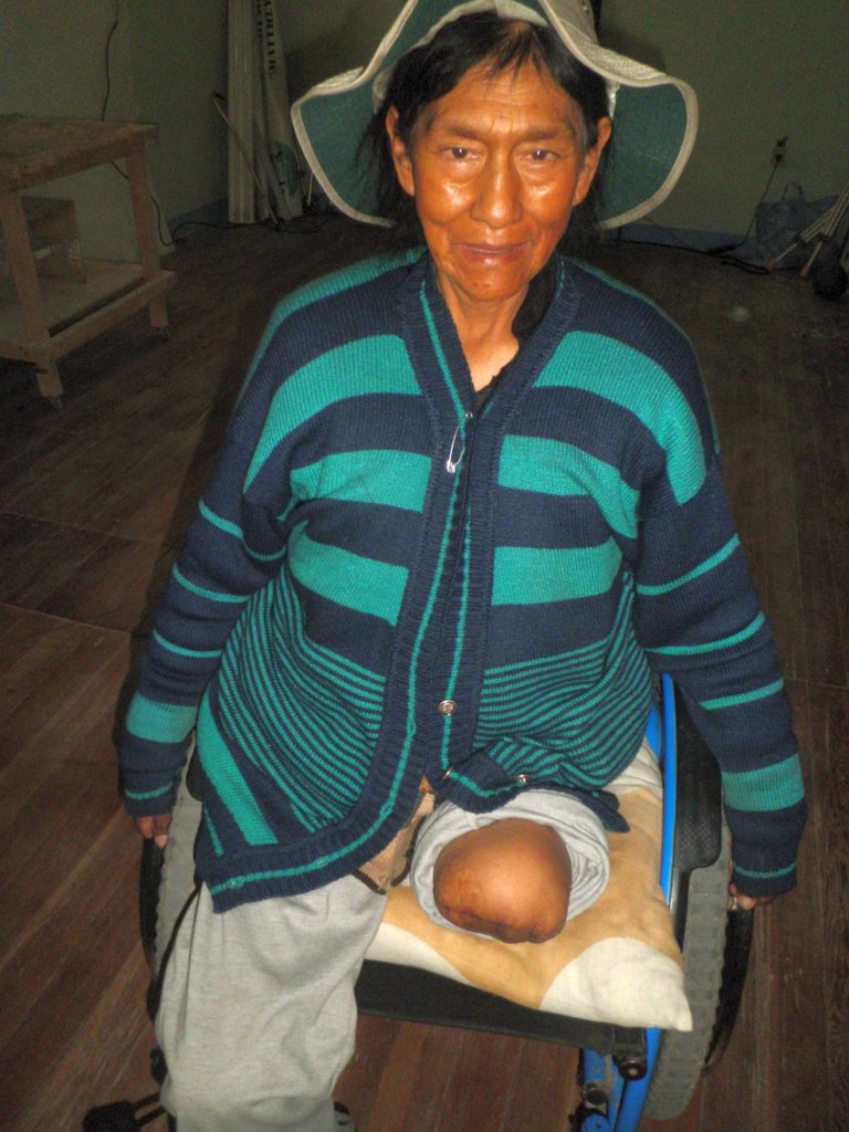 Prosthetic Limbs for 50 Poor Bolivian Amputees