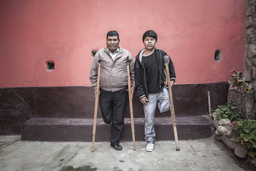Prosthetic Limbs for 50 Poor Bolivian Amputees