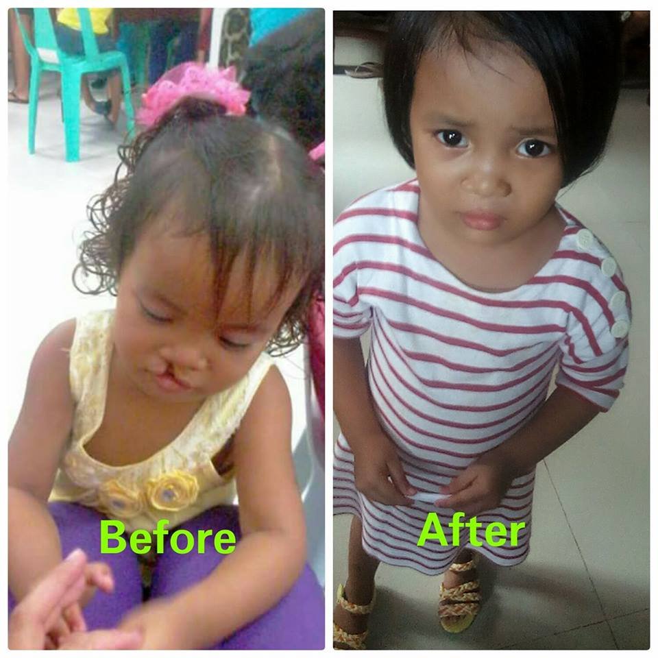 Philippine Medical Outreach 2017 for 2000 patients