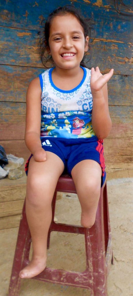 Hands, Feet and Leg for Maria