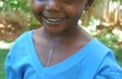 Save a Child's Heart from Developing Countries