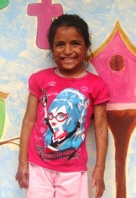 Help Cesia Walk Again!