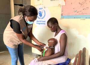 The armband is red, Ocan is severely malnourished