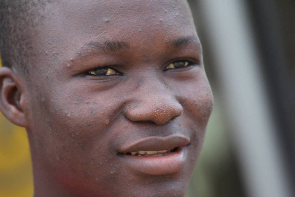 Build a Home for 34+ Street and Vulnerable Youths