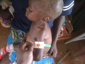 Assessing a child for malnutrition