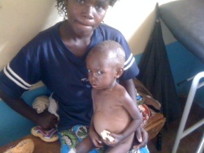 A severely undernourished Mirriam with her mother
