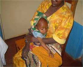 A child with malnutrition in Kisesini