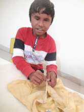 Activity of Daily Living