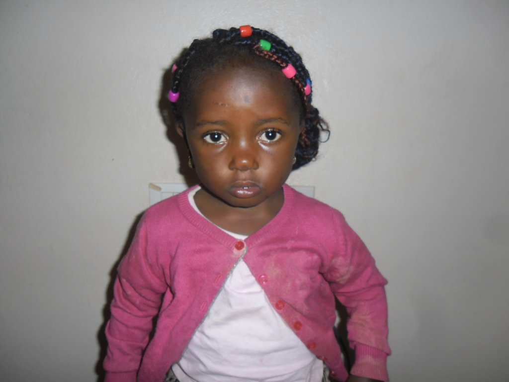 Cardiac Surgery for 4 African Children
