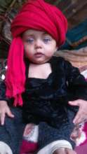 Little Arifa, awaiting her surgery
