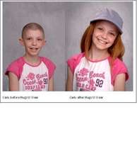 Carly Before and After Hugs U Wear