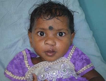 Establish Kolkata Comprehensive Cleft Care Centre