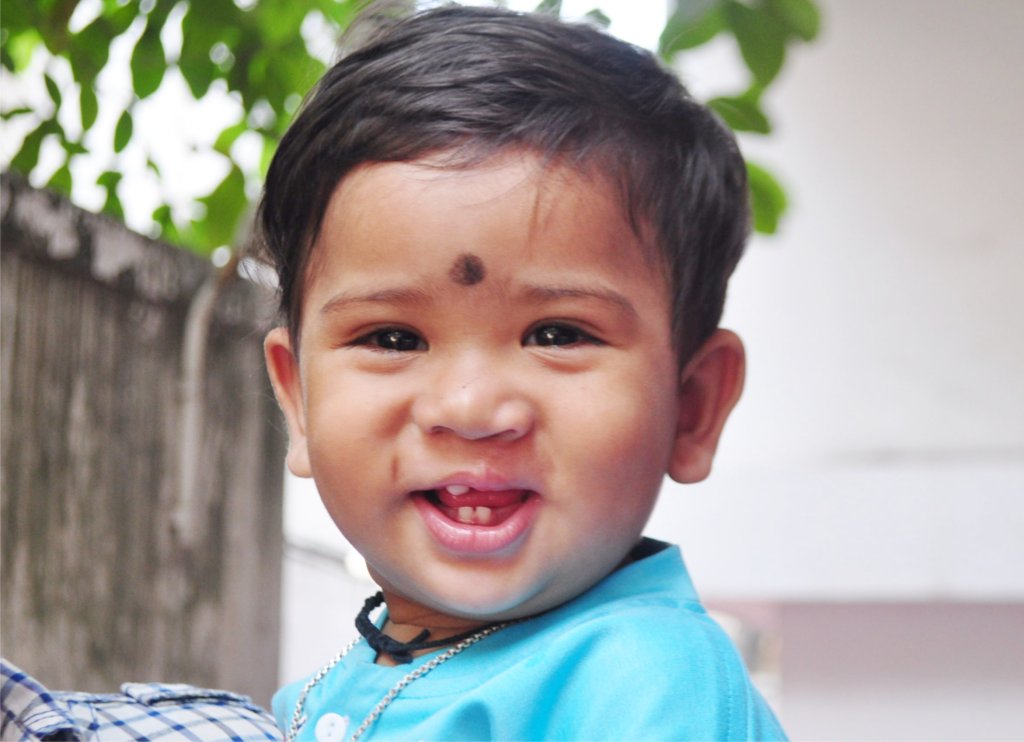 Establish Kolkata Comprehensive Cleft Care Centre
