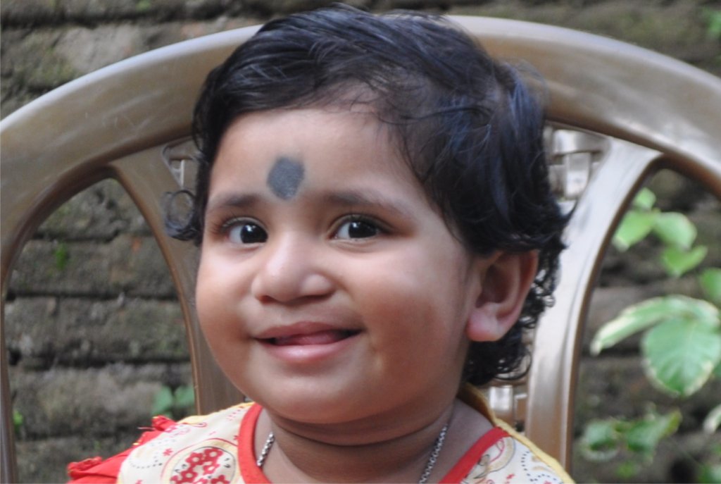 Establish Kolkata Comprehensive Cleft Care Centre