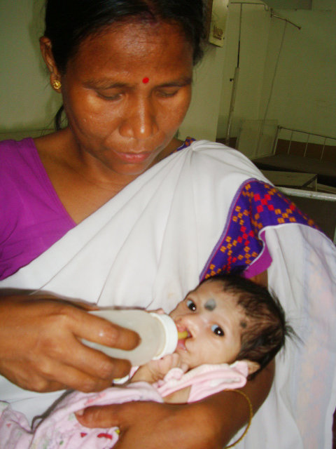 Establish Kolkata Comprehensive Cleft Care Centre