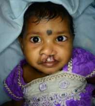 Lakhi  Before