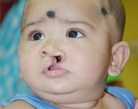Subham Before